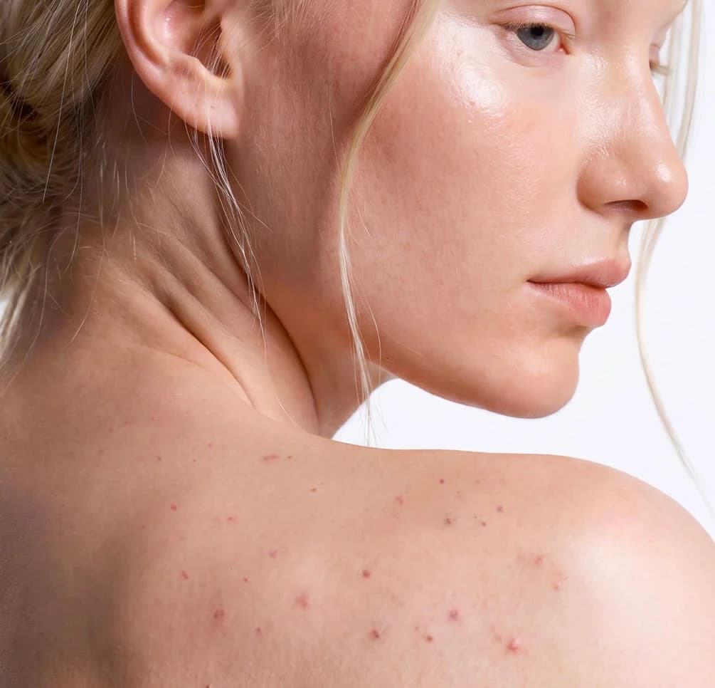 Is body care just about moisturizing